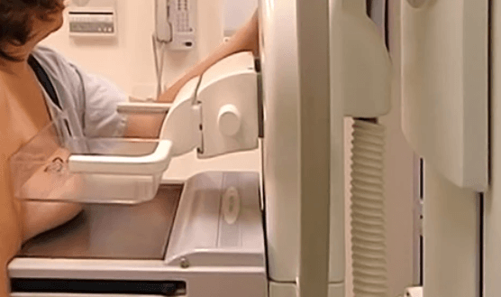 Mammography